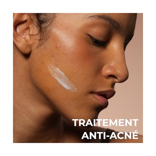 ALKEMY Crème Anti Boutons Visage, forte action Apaisante, Purifiante et Anti Tache - Réduit rapidement les Imperfections et l