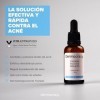 NOVA ENGEL 2% Ácido Salicílico + 1% Zinc Sérum Facial 30 ml