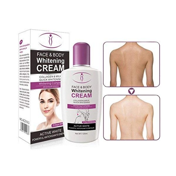 Bluelover 120Ml Crème Blanchissant La Peau pour Le Visage De La Peau Foncée Lotion Blanchissant La Crème Faciale