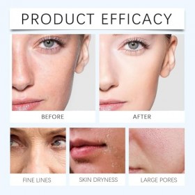 Sérum Turmskin, Sérum à lacide hyaluronique Turmskin, Ampoules ultra-hydratantes de sérum à lacide hyaluronique 3%, sérum f C...