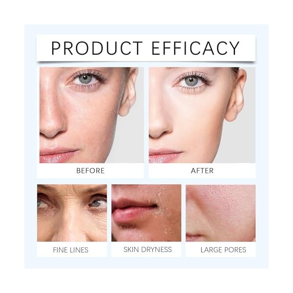 Sérum Turmskin, Sérum à lacide hyaluronique Turmskin, Ampoules ultra-hydratantes de sérum à lacide hyaluronique 3%, sérum f C...