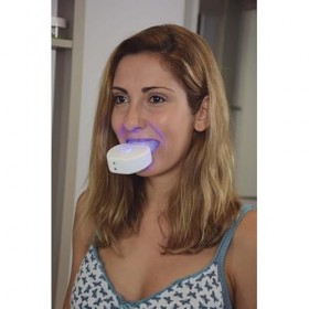venteo - EXPRESS BRUSH - Brosse à dents automatique - Brossage sur 360° - Blanc – Adulte – Sadapte à toutes les mâchoires