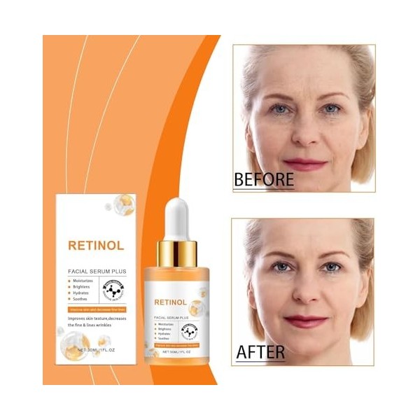 Sérum visage au rétinol, sérum visage anti-âge au rétinol, sérum visage anti-rides au rétinol, sérum au rétinol pour la peau ...