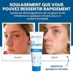 Grahams Natural C+ Cream - Crème pour Peaux Sèches, Démangeantes, Rouges et à Tendance Eczéma - Au Miel de Manuka et au Calen