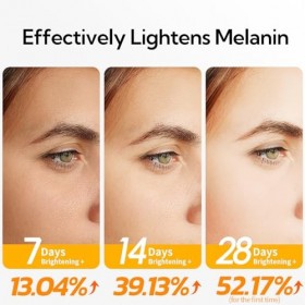 Sérum visage vitamine C 20 % 30 ml / 1 fl, nettoyant pour la peau, taches sombres, réduit les rides, sérum éclaircissant anti