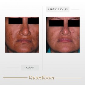 Laboratoires DermEden Lumixderm Crème Éclaircissante Visage 40ml - Décapeptide-12 & Glutathion - Corrige les taches pigmentai...