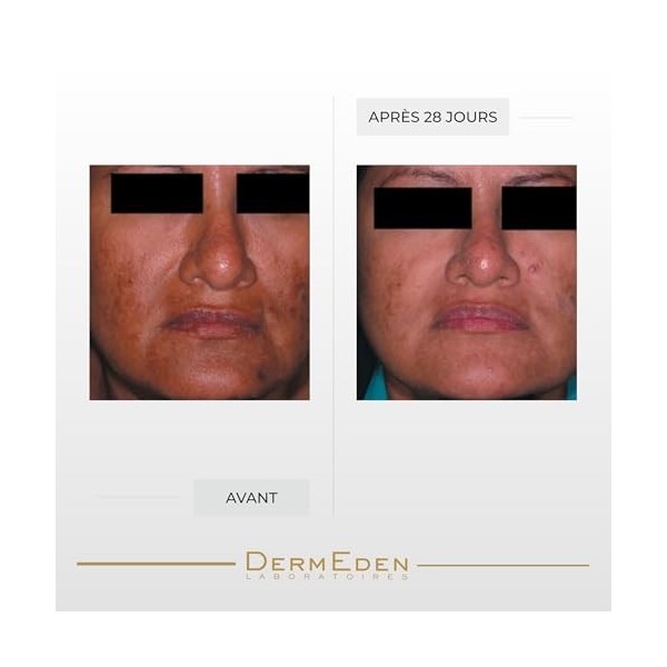 Laboratoires DermEden Lumixderm Crème Éclaircissante Visage 40ml - Décapeptide-12 & Glutathion - Corrige les taches pigmentai...