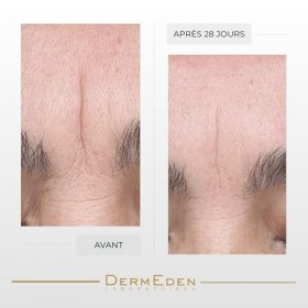 Laboratoires DermEden - Concentré Repulpant et Hydratant 30 ml - Réduit les rides, Améliore lhydratation et Stimule le colla ...