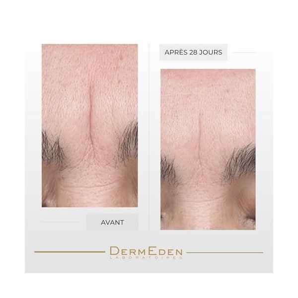 Laboratoires DermEden - Concentré Repulpant et Hydratant 30 ml - Réduit les rides, Améliore lhydratation et Stimule le colla ...