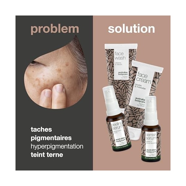 Réduisez les problèmes de pigmentation sur le visage avec un ensemble de 4 pièces composé dun nettoyant pour le visage, dun