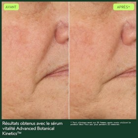 Advanced Botanical Kinetics Sérum Vitalité | Réduit l’apparence des ridules et des rides | Pour tous les types de peau | 96% 