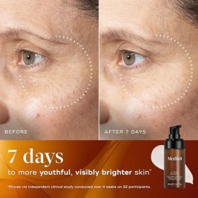 Medik8 C-Tetra Advanced – 20 % de vitamine C – Sérum avec exosomes – Défense contre le vieillissement prématuré de la peau et...