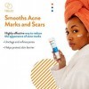 AcneFree Sérum resurfaçage des marques de rétinol, avec de lacide hyaluronique pour réduire les marques et les cicatrices, d
