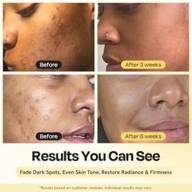 Gleamin Superactive Serum 30ml
