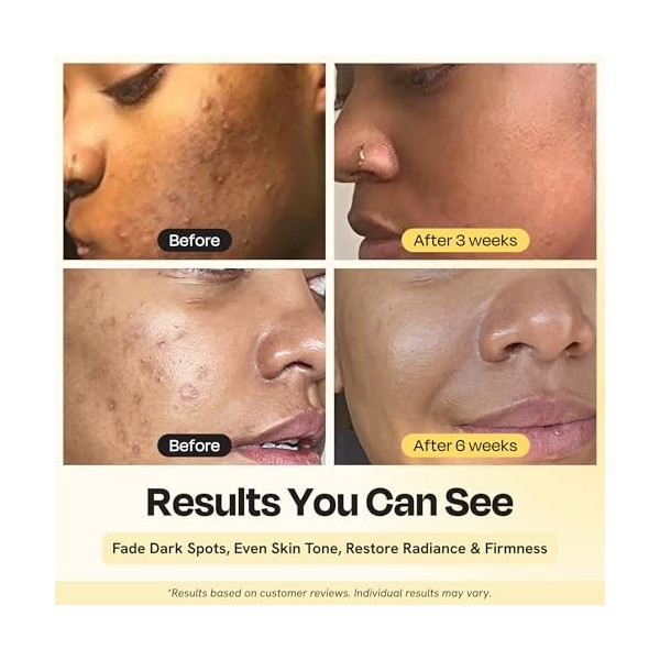 Gleamin Superactive Serum 30ml