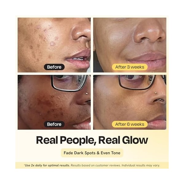 Gleamin Hydratant éclaircissant à la vitamine C – Vitamine C, beurre de karité, céramides, électrolytes et curcuma – Hydrate