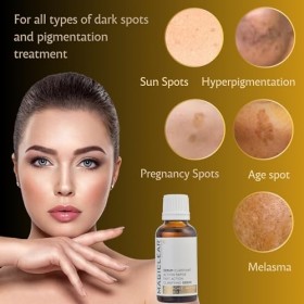 Sérum de luxe pour enlever les boutons noirs du visage et du corps, correction des taches de vieillesse cicatrice dacné, ant