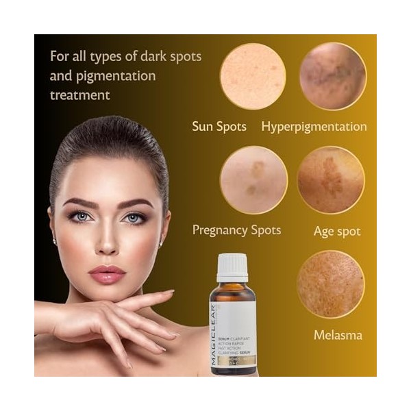 Sérum de luxe pour enlever les boutons noirs du visage et du corps, correction des taches de vieillesse cicatrice dacné, ant