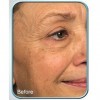 Biologic Stem Cell Therapy Set of 4 Jars for Deep Wrinkles - by BioLogic