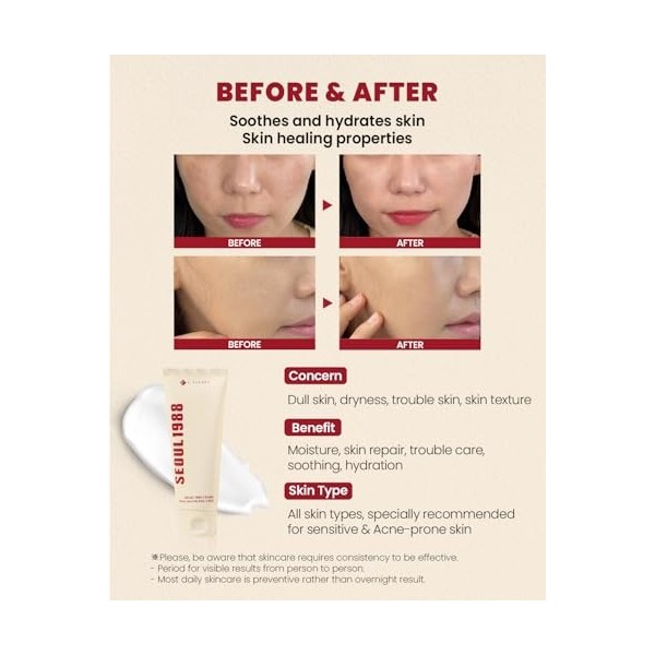 K-SECRET SEOUL 1988 Snail Mucin Crème 93 % – Formule concentrée mais légère infusée avec 93 % de mucine descargot | Crème vi