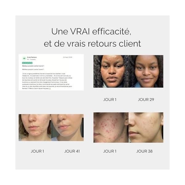 Baume de nuit Anti-Acné - 30ml