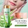 Tonique à Laloe Vera, Lotion Daloe Vera Hydratant Nourrissant, Hydrater Le Visage Après Une Exposition Au Soleil, Réduire L