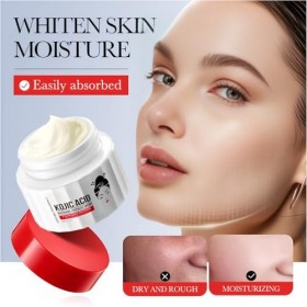 Crème Éclaircissante Visage À LAcide Kojique, Crème Anti-Taches Pour Une Peau Lumineuse Et Uniforme, Estompe Les Taches De V
