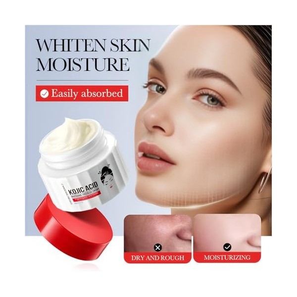 Crème Éclaircissante Visage À LAcide Kojique, Crème Anti-Taches Pour Une Peau Lumineuse Et Uniforme, Estompe Les Taches De V