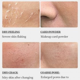 Crème hydratante intensive, peau très sèche & sensible, crème de jour légère sous maquillage, lot de 2 pièces