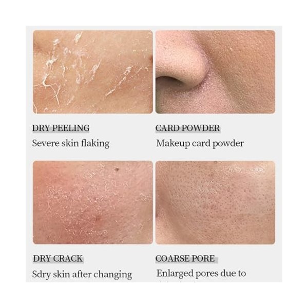 Crème hydratante intensive, peau très sèche & sensible, crème de jour légère sous maquillage, lot de 2 pièces