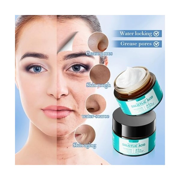 Crème Réparatrice Contrôle Séborrhée À L’Acide Salicylique, Réduit La Brillance Et Régule La Production De Séboum Efficacemen