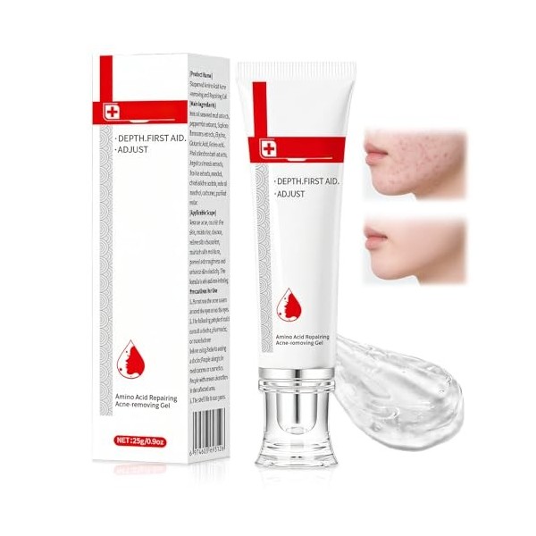 25g Crème Anti Acné, Anti-Boutons Gel, pour Éliminer les BoutonsImperfections Localisées,Apaisantes et Hydratantes pour Soin