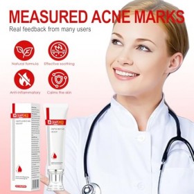 25g Crème Anti Acné, Anti-Boutons Gel, pour Éliminer les BoutonsImperfections Localisées,Apaisantes et Hydratantes pour Soin 