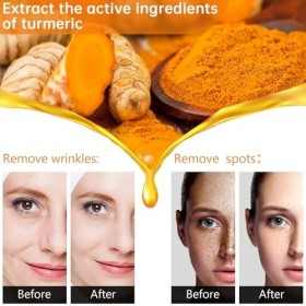 Sérum Visage Curcuma, Éclat Immédiat Et Uniformisation Du Teint, Réduction Des Taches Sombres Et Des Imperfections, Action An