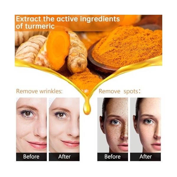 Sérum Visage Curcuma, Éclat Immédiat Et Uniformisation Du Teint, Réduction Des Taches Sombres Et Des Imperfections, Action An