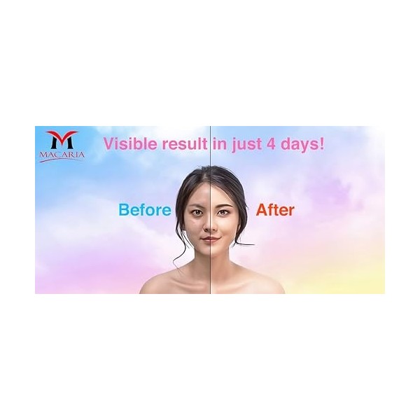 Ivanka Crème Blanchissante Beauté Intime - pour Femmes & Hommes - avec Glutathione, Acide Kojique & Alpha Arbutin - pour Zone