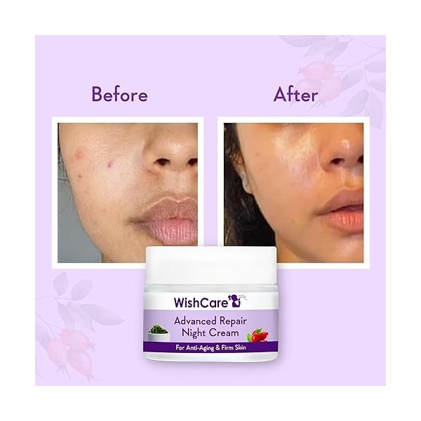 WishCare Crème de nuit réparatrice au collagène - Avec rétinol, niacinamide, pépins de raisin, algues marines, jojoba et cyno