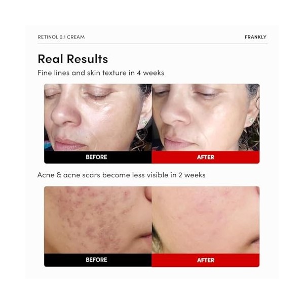 FRANKLY Crème au rétinol 0,3 %, 20,7 ml – Rétinol intensif coréen | Crème de nuit | Céramides et ginseng naturel | Anti-âge, 