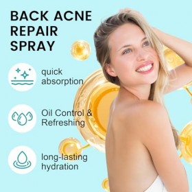 Spray De Traitement De Lacné du Dos,Spray Pour le Dos et Le Corps, Dacné Brume de Soin,Doux pour La Peau,Nettoyage en Profo