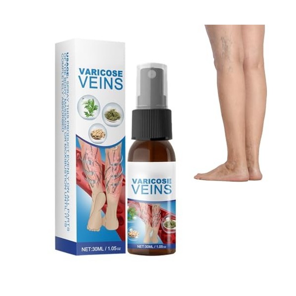 Spray Pour Varices, Varicose Veins Spray, Varicose Veins Cream, Convient À Tous Les Types De Peau, Hydrate, 30ml