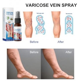Spray Pour Varices, Varicose Veins Spray, Varicose Veins Cream, Convient À Tous Les Types De Peau, Hydrate, 30ml