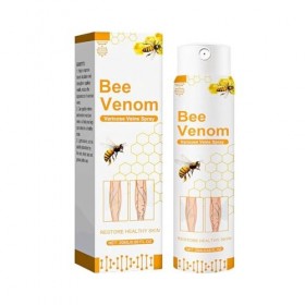 Spray Pour Les Varices,Spray Apaisant Pour Varices,Vaporisateur Naturel De Traitement Des Varice Veineuses Cicatrisantes,Trai