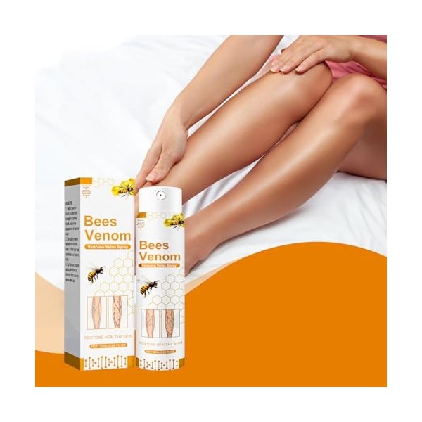 Spray Pour Les Varices,Spray Apaisant Pour Varices,Vaporisateur Naturel De Traitement Des Varice Veineuses Cicatrisantes,Trai