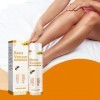 Spray Pour Les Varices,Spray Apaisant Pour Varices,Vaporisateur Naturel De Traitement Des Varice Veineuses Cicatrisantes,Trai