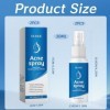 2 Pièces Acide hypochloreux Spray, Spray pour le visage et la peau, sûr pour la peau, à utiliser sur le cuir chevelu sec et a...