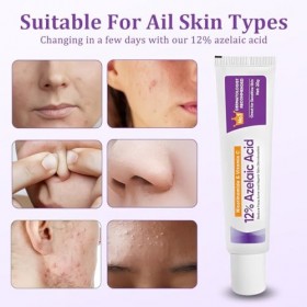 EIROVYA Sérum à Lacide Azélaïque 12%,Serum Visage,Cream Azelaic Acid,Crème Dessence pour le Visage à Lacide Azélaïque 12%,