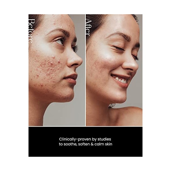 SON&PARK Beauty Water 340 ml 11.49 fl. oz | Multi-Purpose Toner for Oil Control Hydrating Exfoliating Skin Care Daily Clean