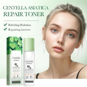 Lotion Tonique À La Centella Asiatica Pour Une Peau Claire Et Radieuse, Aide À Réduire Les Rougeurs Et LInconfort Cutané, So
