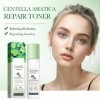 Lotion Tonique À La Centella Asiatica Pour Une Peau Claire Et Radieuse, Aide À Réduire Les Rougeurs Et LInconfort Cutané, So