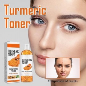 Tkekruh Toner Turmeric 2PC Turmeric Toner au Curcuma 100ml Tonique Exfoliant pour le Visage Turmeric Dark Spot Corrector Seru